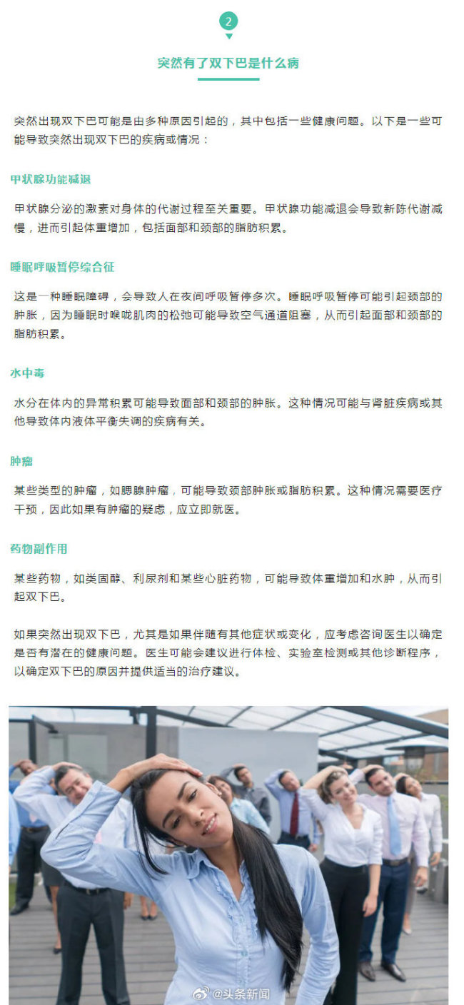 双下巴或是这5种原因造成 突然有了双下巴是什么病