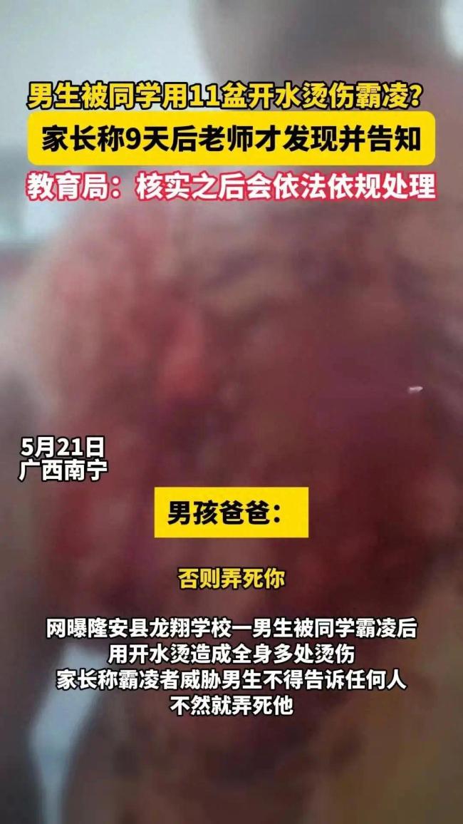 南宁男生疑被同学倒11盆开水：2人被刑拘！