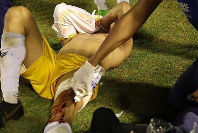 活久见系列！巴西足坛又闹巨大丑闻，警察拿枪射中球员大腿受重伤