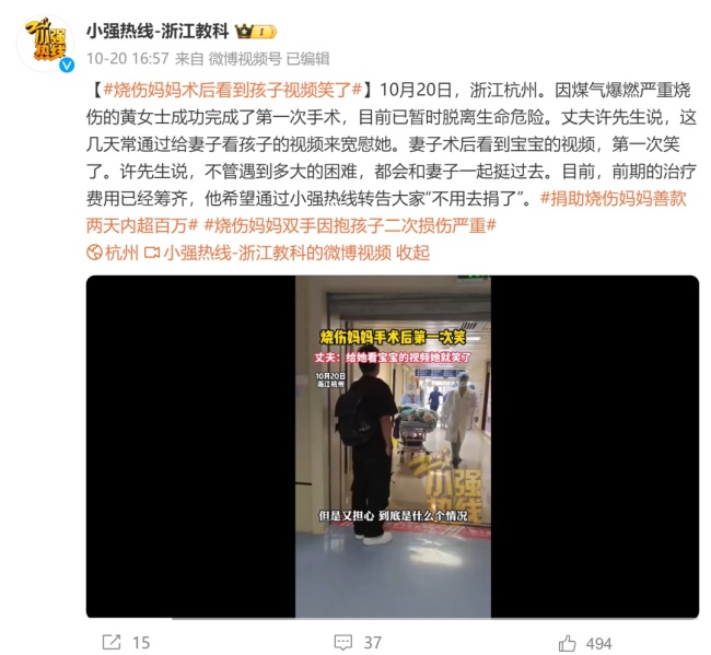 丈夫称烧伤妈妈已经有了求生欲 术后首笑看宝宝视频