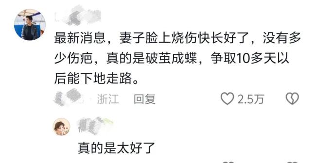 泪目！烧伤妈妈丈夫称不介意是否会留疤