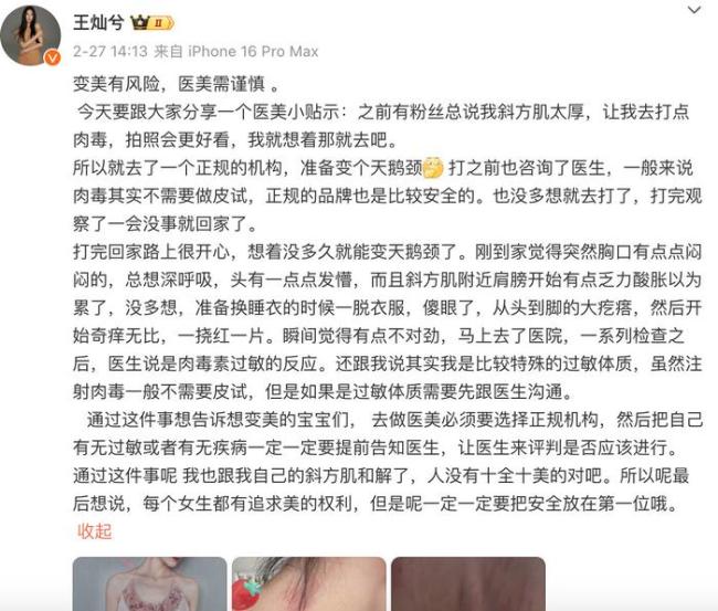 杜淳妻子自曝注射肉毒致全身過(guò)敏