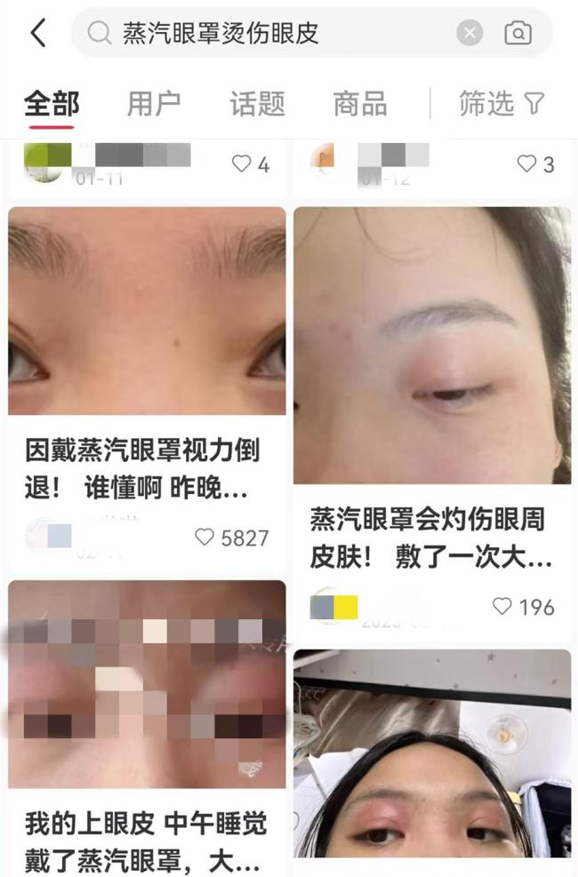 女子戴蒸汽眼罩睡覺致眼角膜燙傷 眼睛疼痛視力驟降