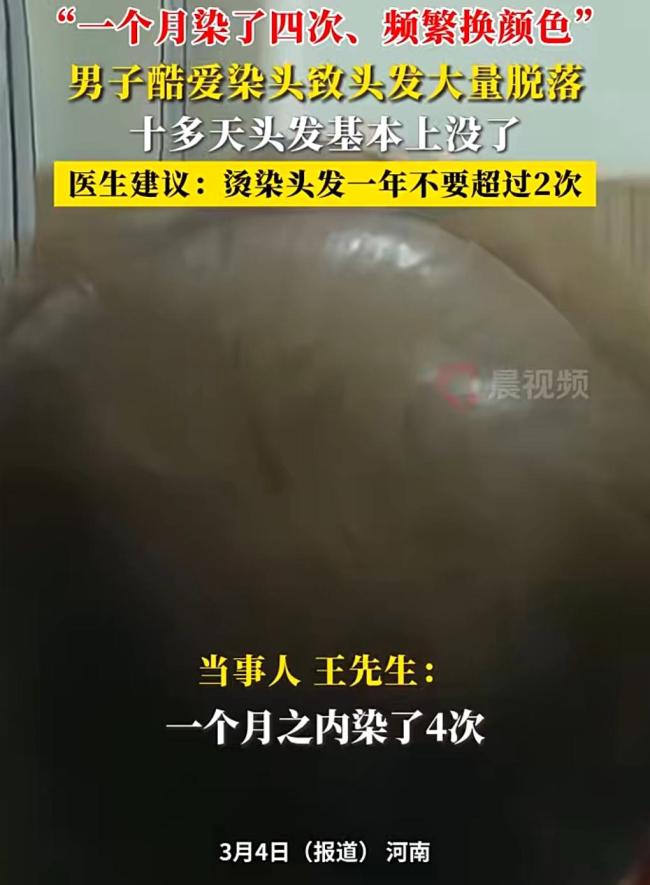 男子一月染頭4次致頭發(fā)脫落