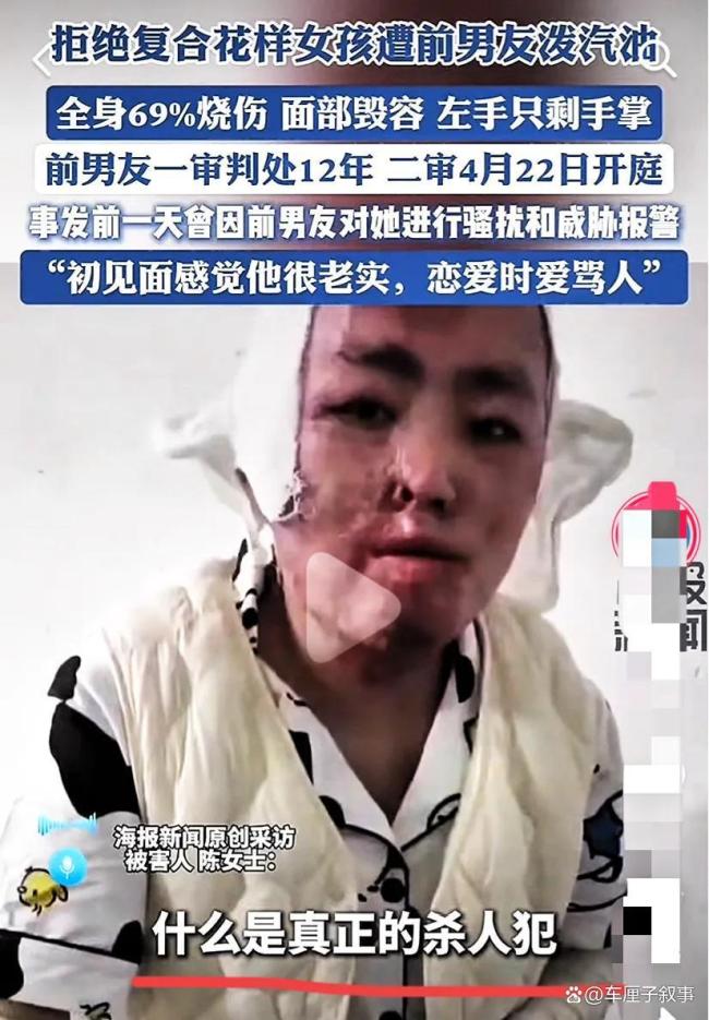 被泼汽油烧伤女孩称可能会直播带货