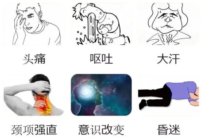 臺州7人確診顱內(nèi)動脈瘤，這些癥狀別忽視 警惕春季高發(fā)