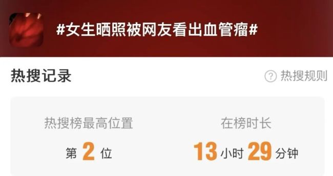 女生曬照被網(wǎng)友看出血管瘤 網(wǎng)友：默默打開手電筒