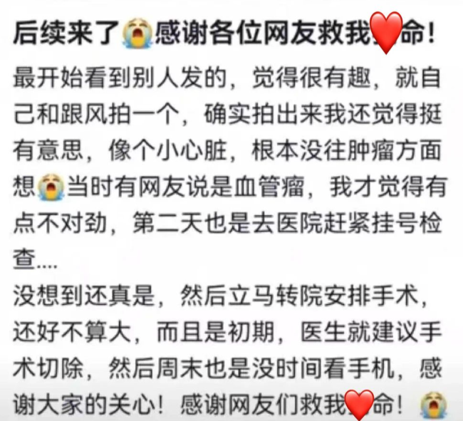女生曬照被網(wǎng)友看出血管瘤 網(wǎng)友：默默打開手電筒