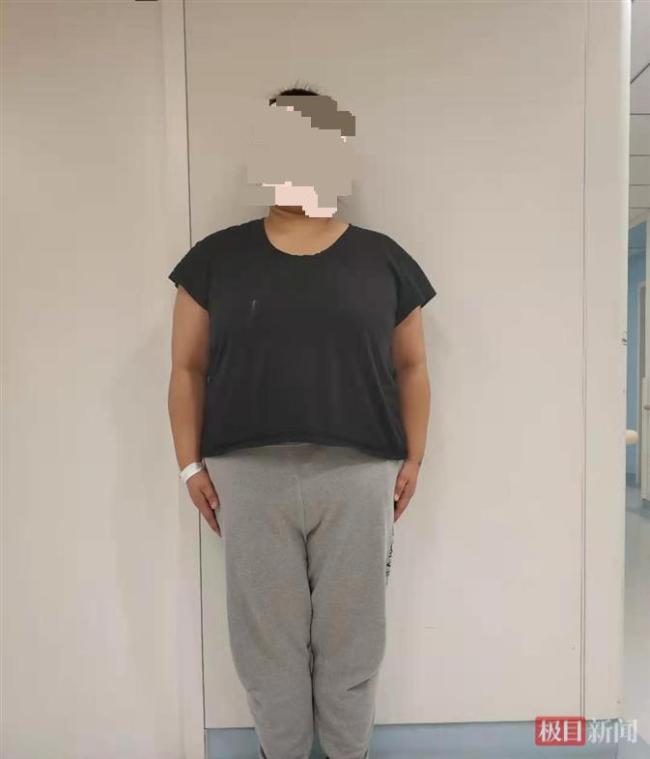220斤大胃王女子半年減掉一半的自己
