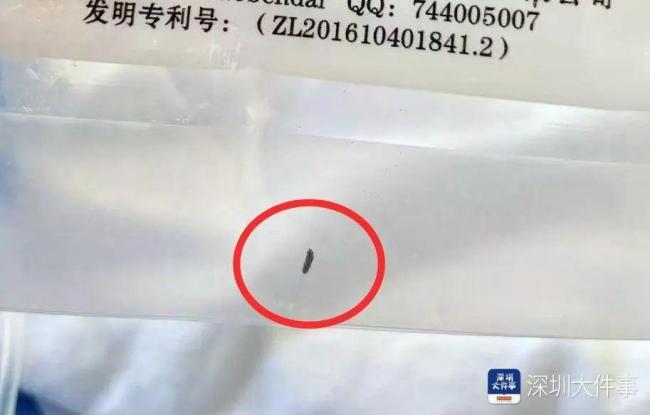 女子拔牙后查出嘴里有“針” 智齒手術(shù)引發(fā)醫(yī)療糾紛