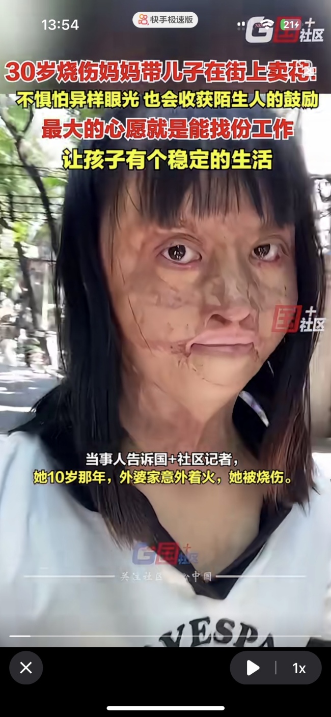 券商：维生素板块结构性行情仍可期待 涨价潮推动业绩高增（烧伤妈妈带着儿子在街上卖