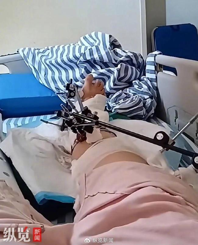 女子從12樓意外墜落奇跡生還 車棚成救命緩沖