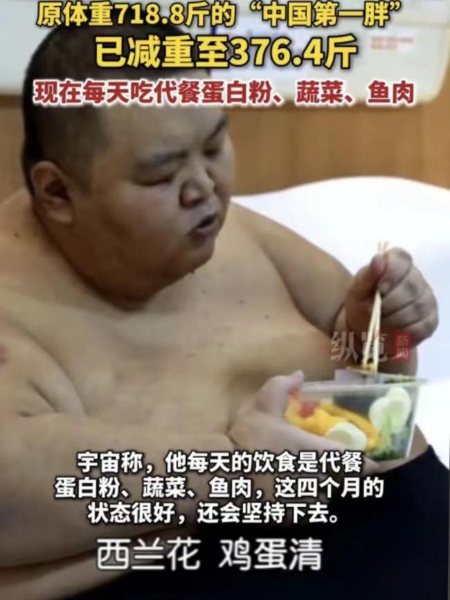 “中國第一胖”切掉70%的胃 體重降至490斤,!