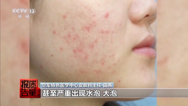 揭開防曬化妝品的“迷霧” “防護(hù)”還是“防曬”