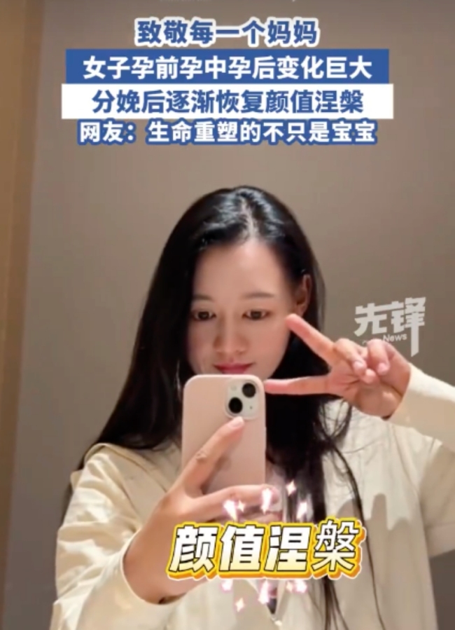 女子分享孕中孕晚分娩后容貌變化 孕激素下的變形記
