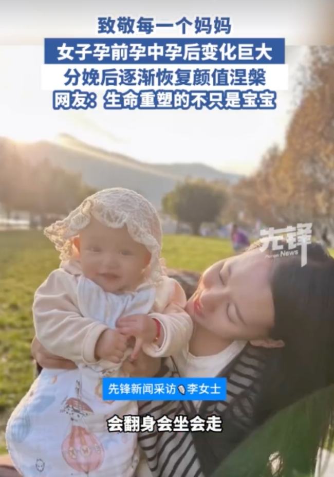 女子分享孕期分娩后容貌變化 孕激素下的變形記