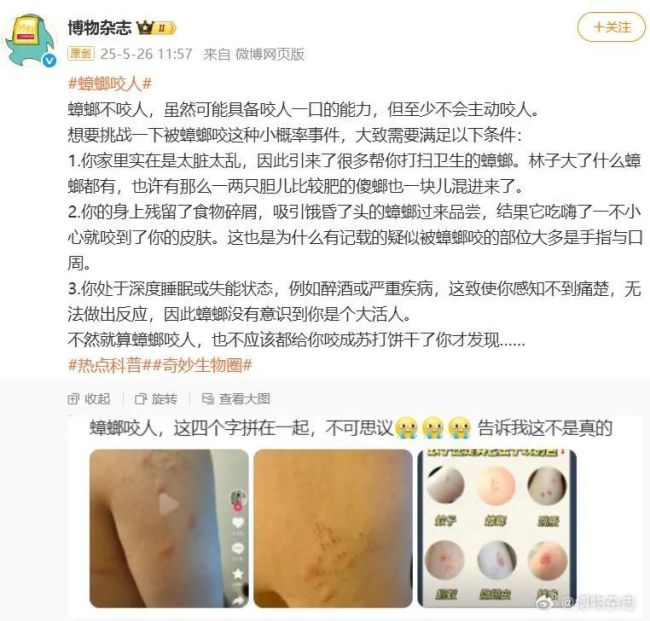 “蟑螂咬人”沖上熱搜,！廣東人如何緊急止癢,？