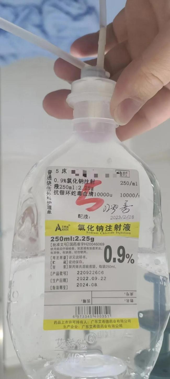 女子躺酒店床上被毒蛇咬伤 后遗症持续2年