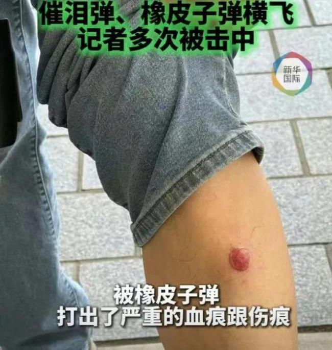 洛杉矶暴乱升级！特朗普派出军警高喊“解放洛杉矶！新华社记者中弹
