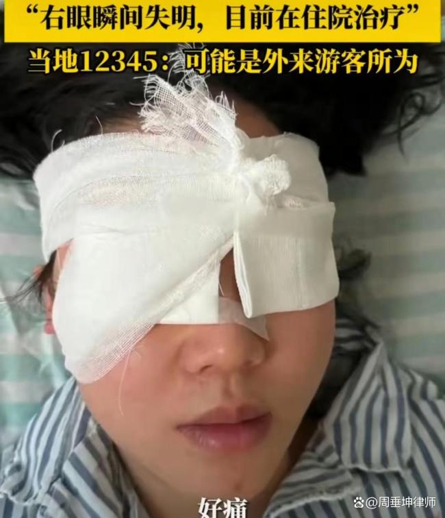 律師分析女孩眼睛遭水槍攻擊失明 游玩變噩夢