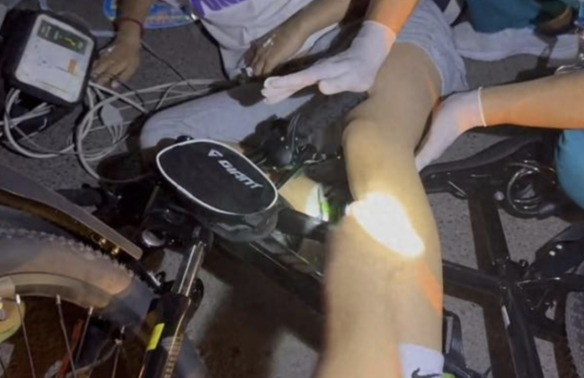 男孩骑行不慎摔倒 自行车插进大腿