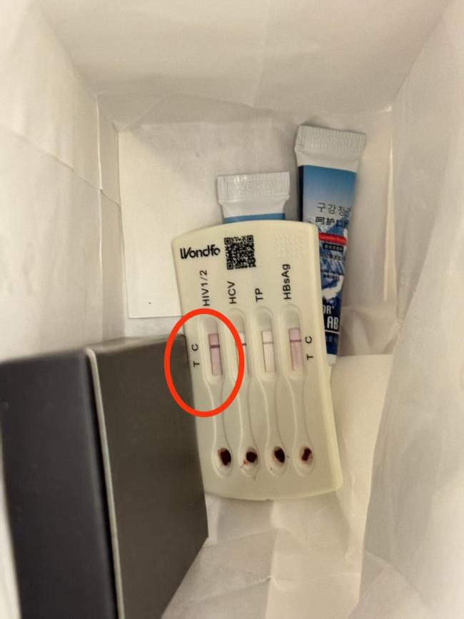 酒店洗漱包內(nèi)發(fā)現(xiàn)用過的HIV檢測盒