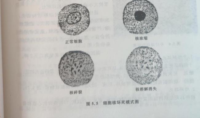 为什么不要反复化冻肉？感染致命菌的风险升高 细菌繁殖隐患增加