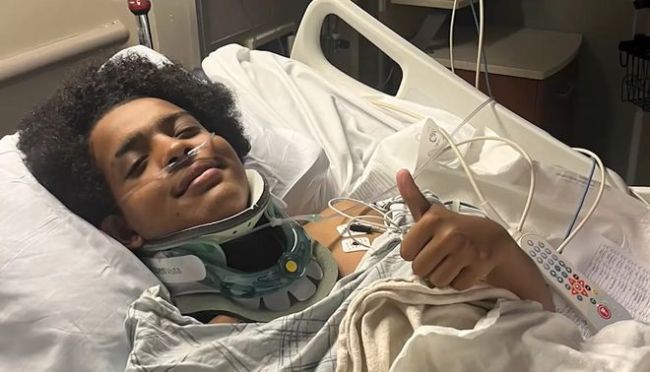 美國15歲男孩遭雷劈 醒后豎大拇指