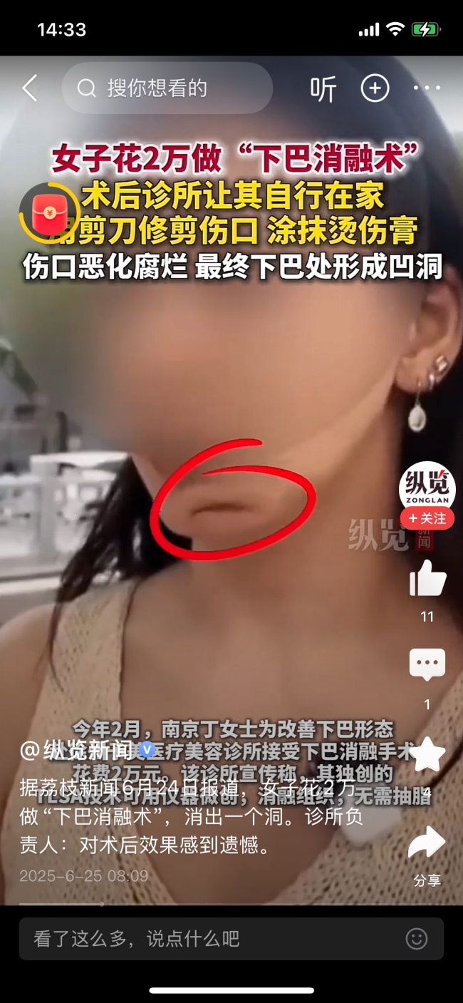 診所讓術(shù)后女子自剪傷口 美容變“毀容”