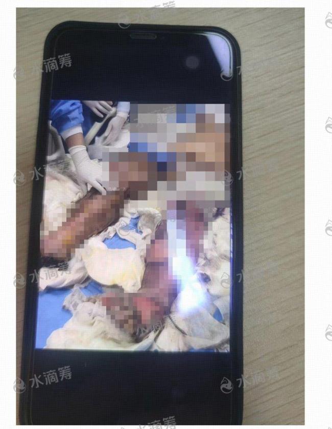 电瓶车飞线充电引火灾致1死2伤 悲剧敲响安全警钟