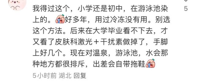 醫(yī)生提醒勿光腳接觸公共區(qū)域地面 小心HPV感染風險