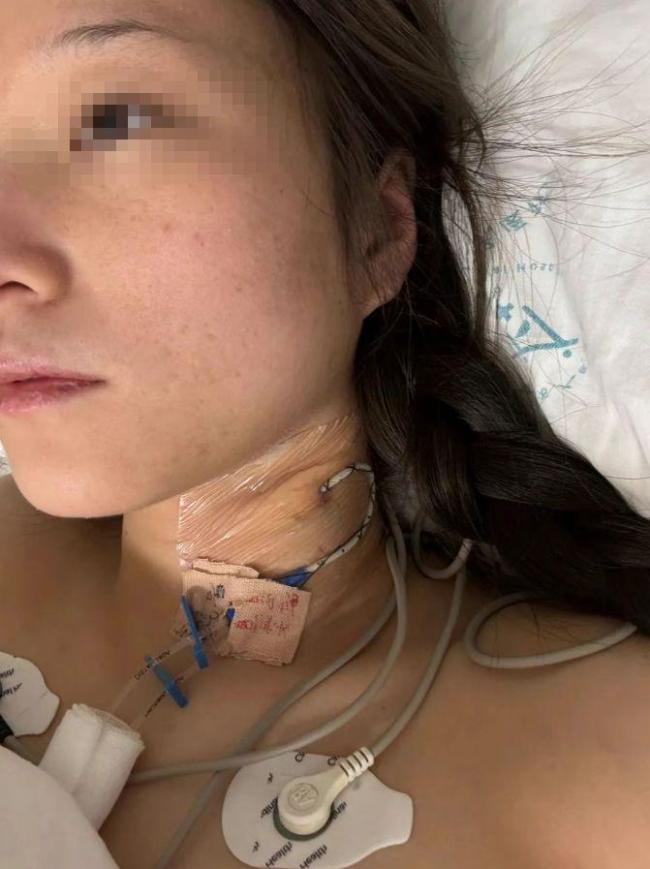 男子駕車出事致女友截癱 雙方發(fā)聲 男友失聯(lián)拒付醫(yī)療費