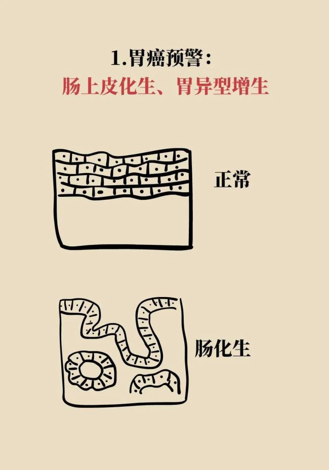 年年体检却患癌？因为你忽视了“最后的警告”，7类癌前病变全解析