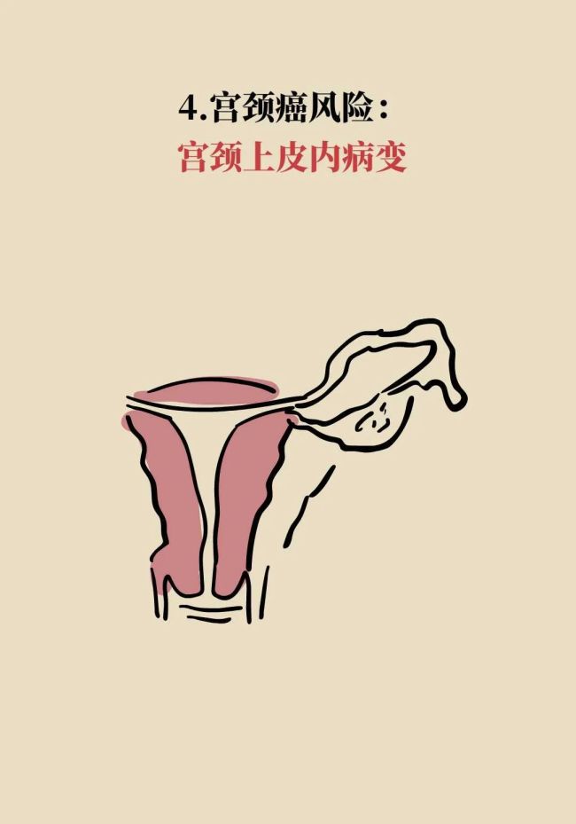 年年体检却患癌？因为你忽视了“最后的警告”，7类癌前病变全解析