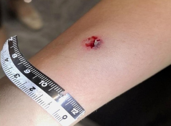 货车司机向路人射钢珠被拘