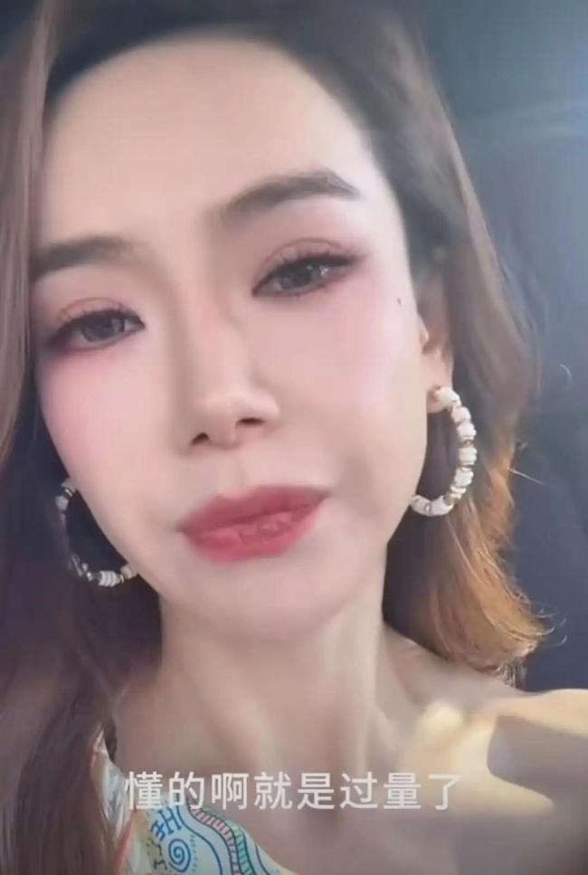 戚薇承认过度医美：打肉毒打僵了 医美翻车现场变脱口秀