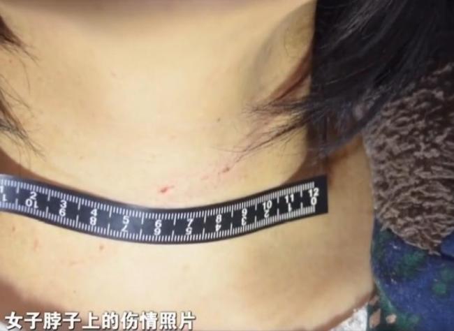 男子杀妻未遂获妻谅解：他是经济来源