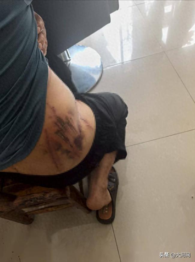 绝迹多年的华南虎湖北伤人？当地回应