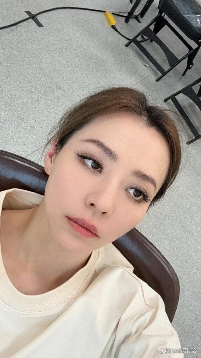 顶流女星突患疾病？张靓颖一伸懒腰手掌就流血