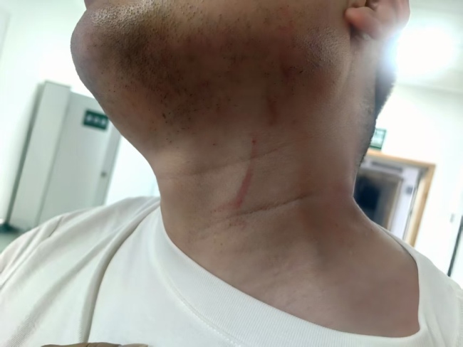 警方回应男子拍违停被当街殴打