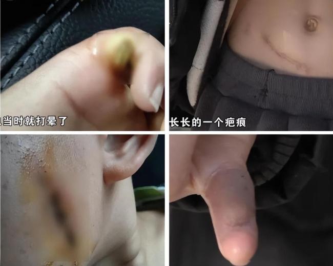 5岁男童小区景观池内触电身亡 妈妈捞孩子时也触电 安全隐患引发关注