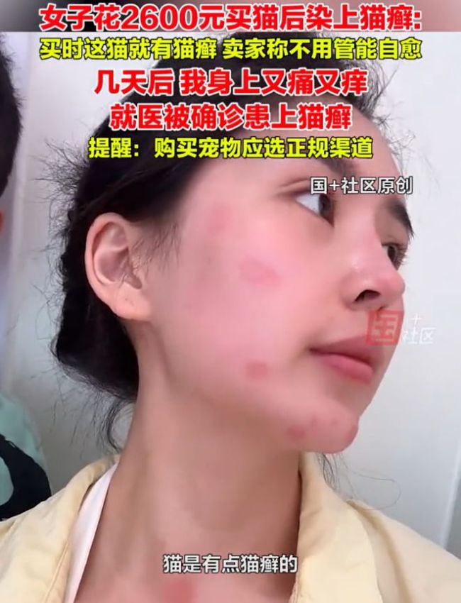 女子2600元买猫被传染满脸猫藓 卖家误导惹祸