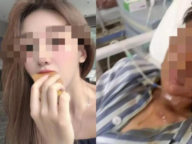 遭家门口快递炸伤女主播家属发声