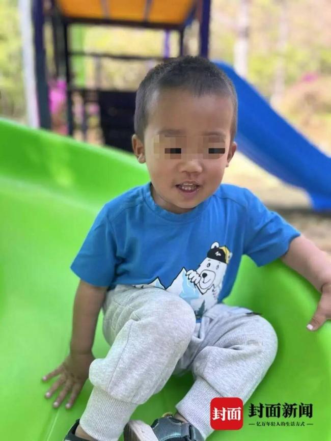 烧烤店内一男童不慎掉进炭堆，全身烧伤 安全防护缺失引发悲剧