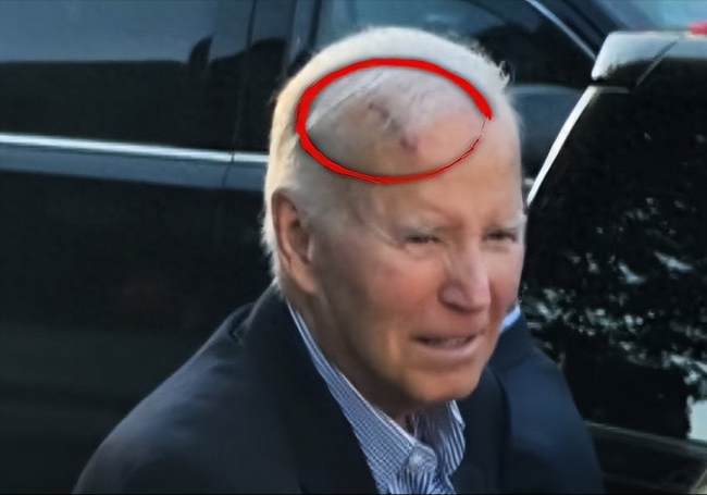 拜登完成为期数周的一轮放射治疗 从白宫到病房的转变