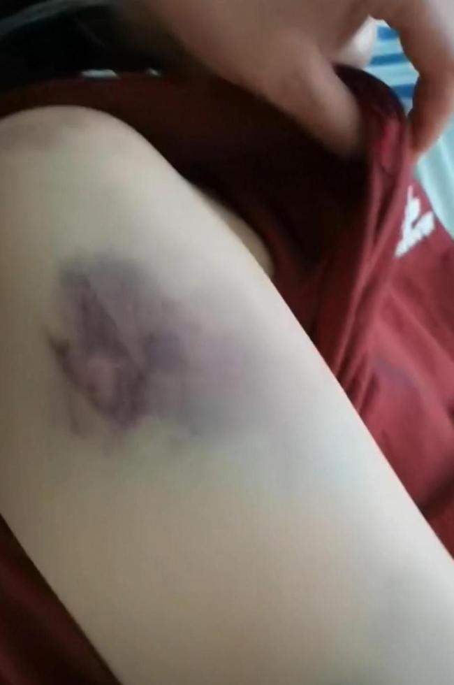 家暴致死案二审未宣判 正当防卫争议再起