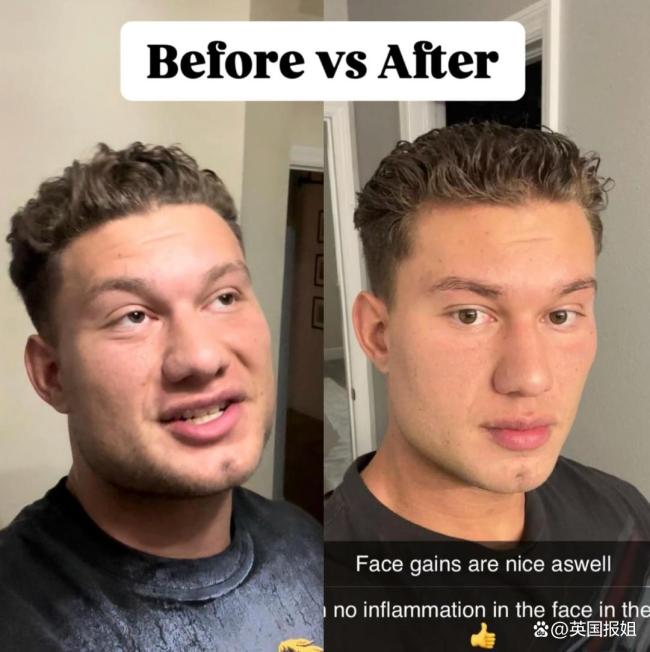 美国男博主因变帅教学走红 容貌极致化引领潮流