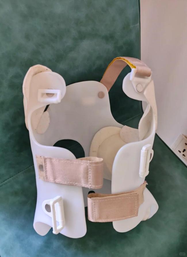 1亿多年轻人正被这病虐待 脊柱问题年轻化警钟