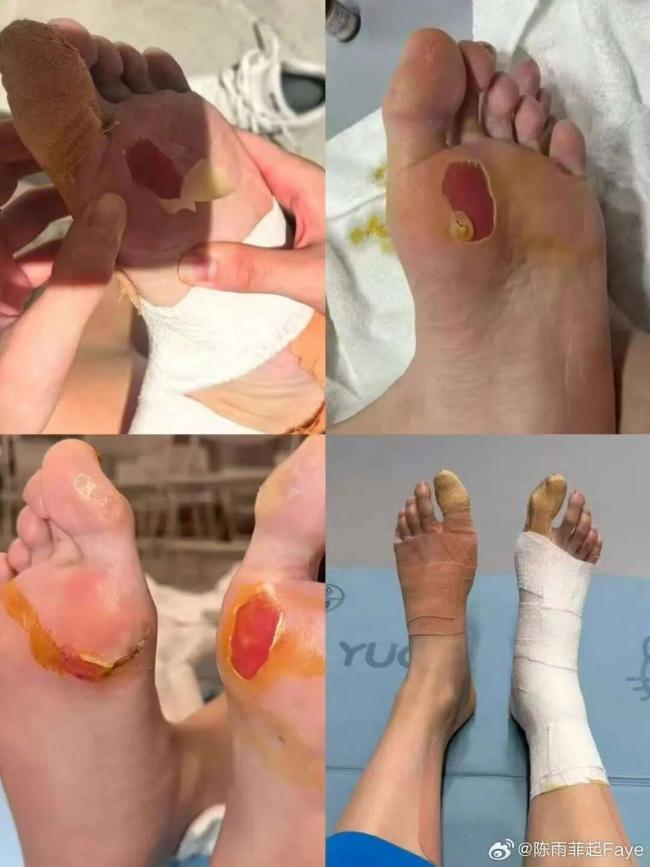 陈雨菲最后一届全运会 带伤拼搏获银牌