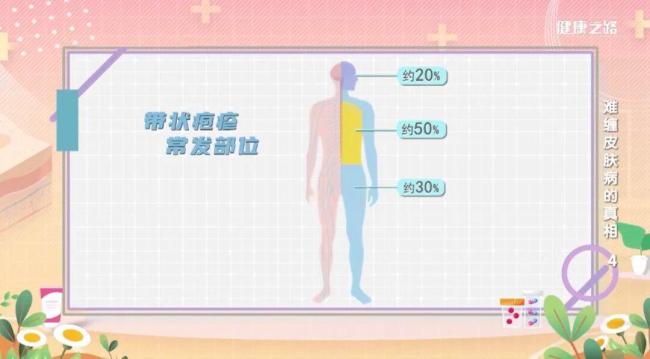 拆完快遞沒洗手，當(dāng)心“惹”上眼部帶狀皰疹